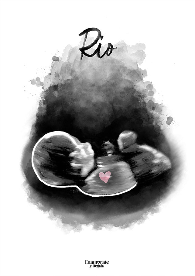 ILUSTRACIÓN ECOGRAFÍA 2D DIGITAL